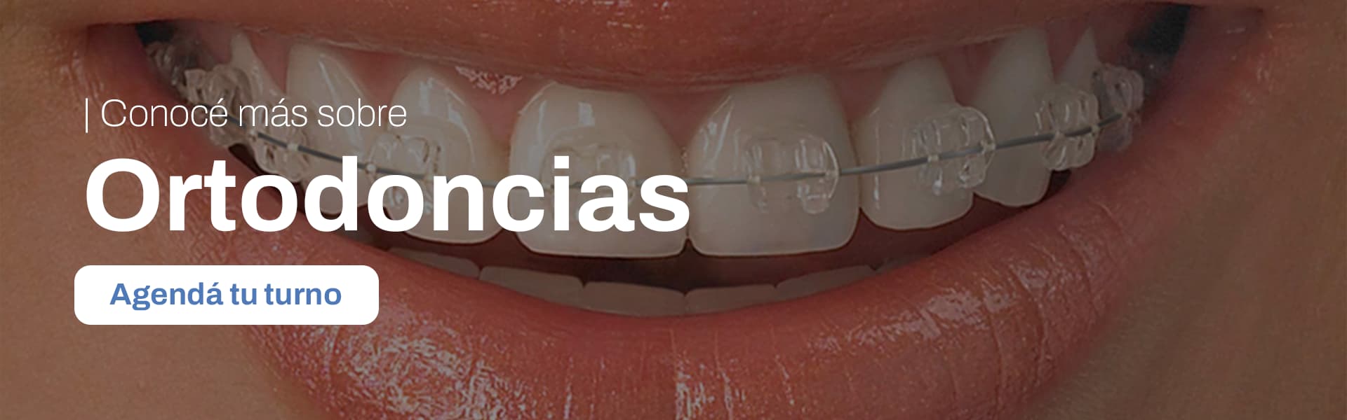Ortodoncia en Rosario - especialista atendiendo paciente en CM Dental
