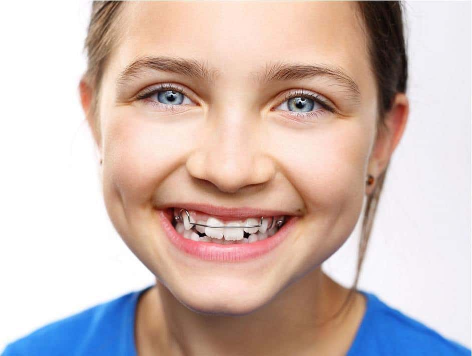 Tratamiento de ortopedia dental en Rosario