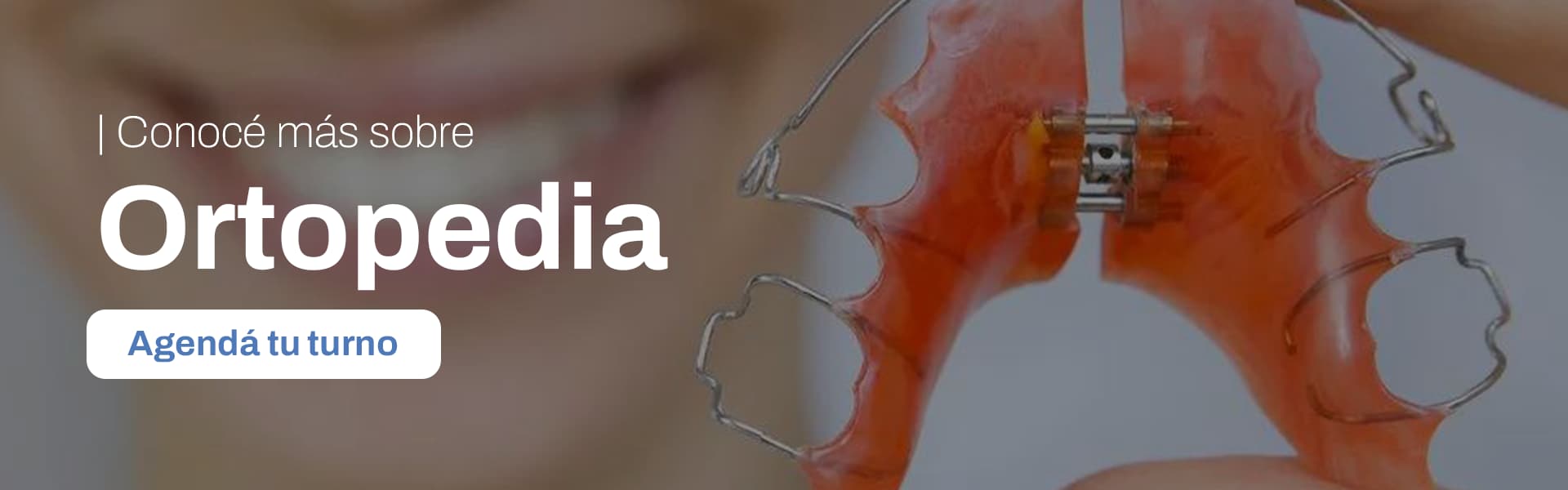 Aparato de ortopedia dentofacial infantil
